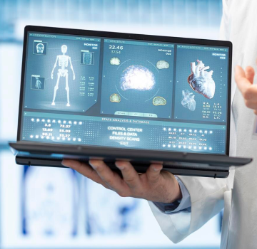 Optimización de recursos